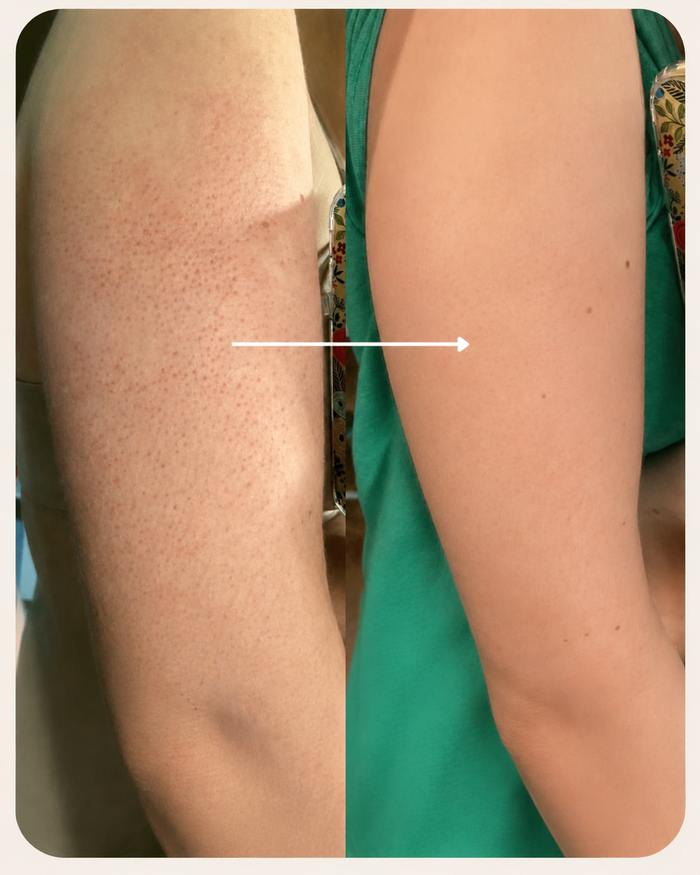 Softer & Smoother Skin