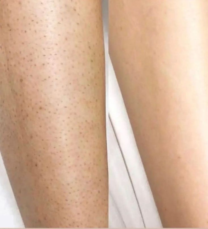Spa-Like Results At Home