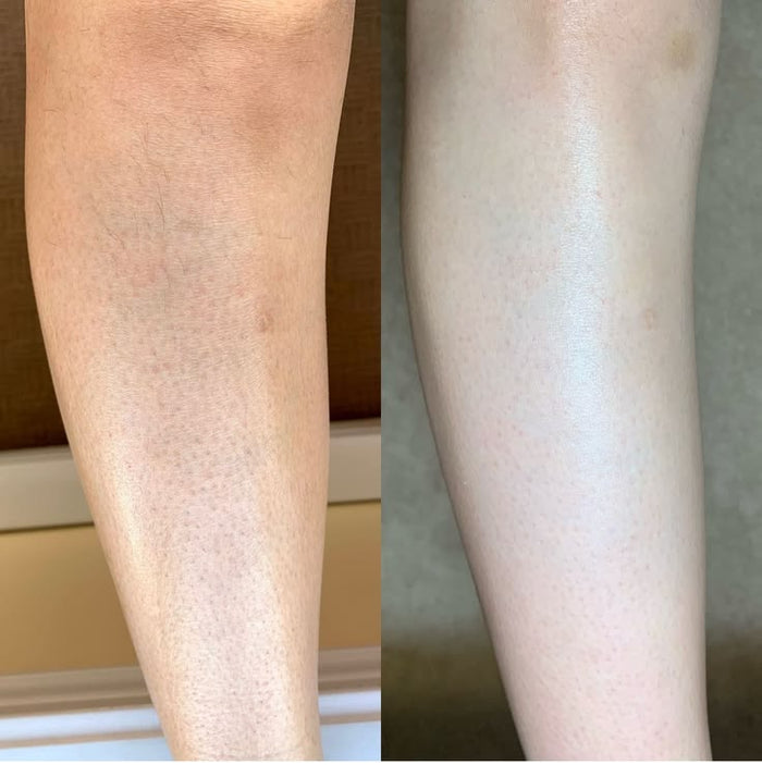 Softer & Smoother Skin