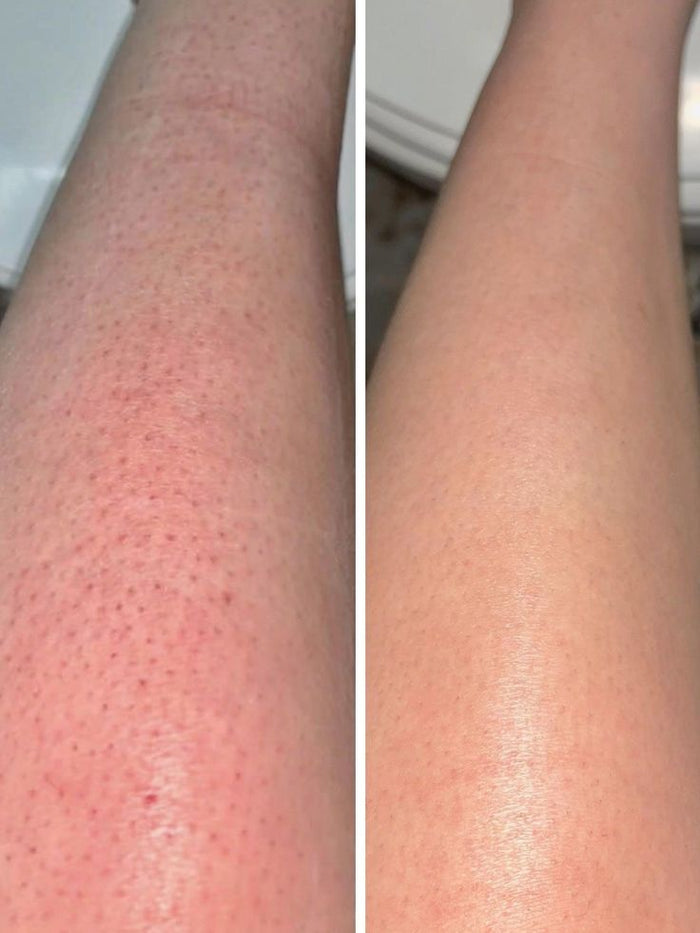Spa-Like Results At Home