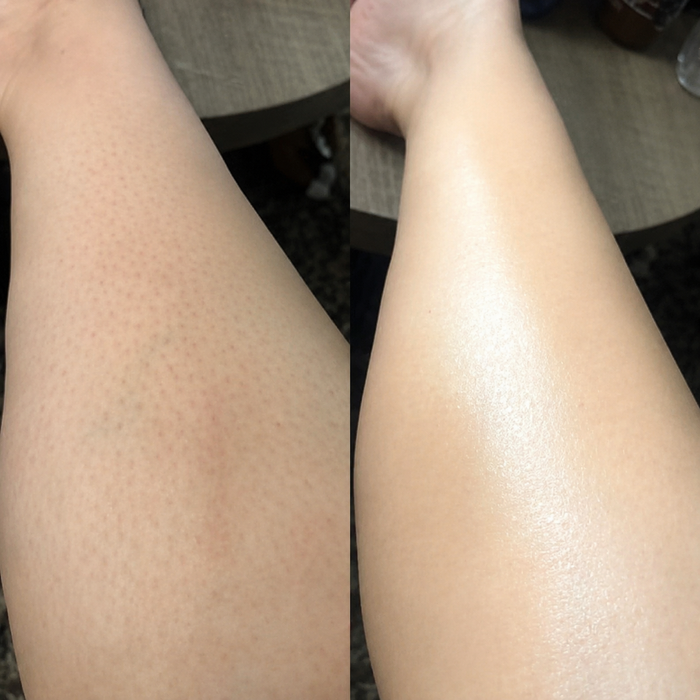 Softer & Smoother Skin