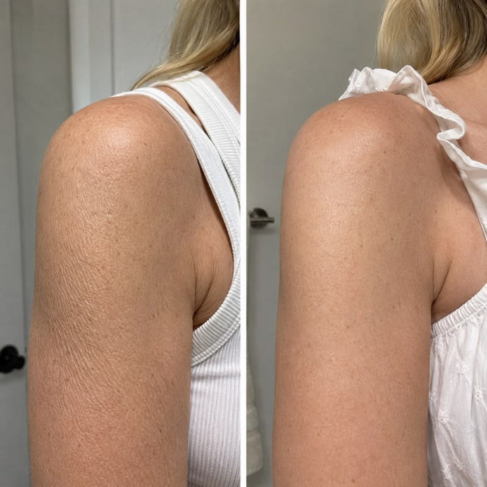 Softer & Smoother Skin