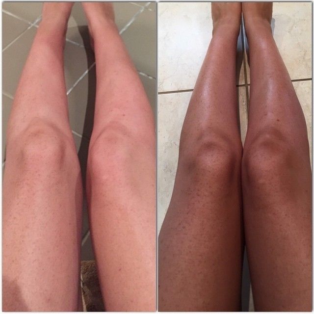 Softer & Smoother Skin